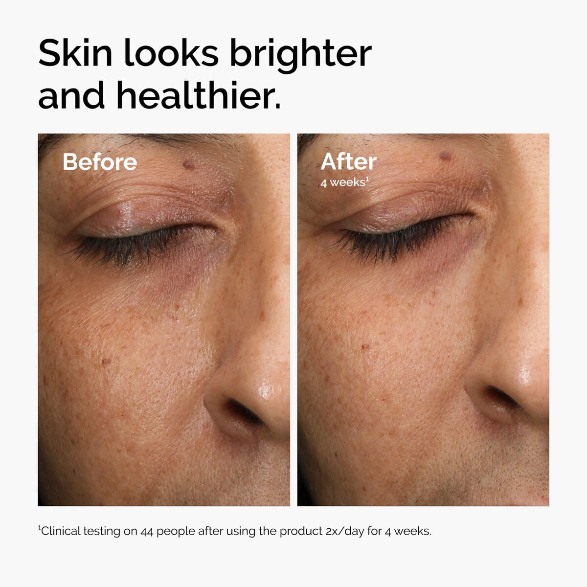 multi-antioxidant-radiance-serum-h5 ord-mars-before-after-healthy.jpg